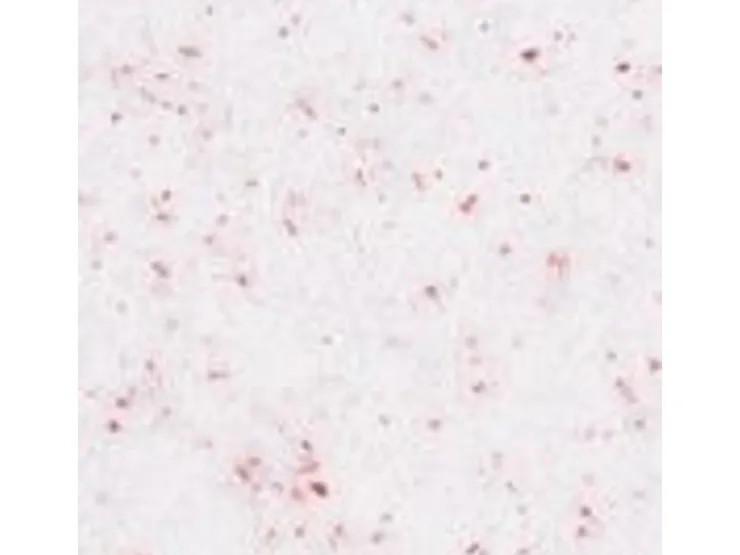 Terralith Buntsteinputz Mosaikputz 1mm -15 kg- BSP1126 Weiss Rot* Außen-Fassadenfarben